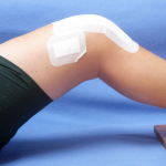postoperative